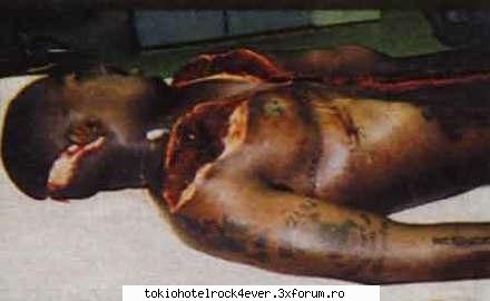 vezi poza el dupa autopsie ...

...  :uimit: 

acum.. e mort sau nu? 2pac