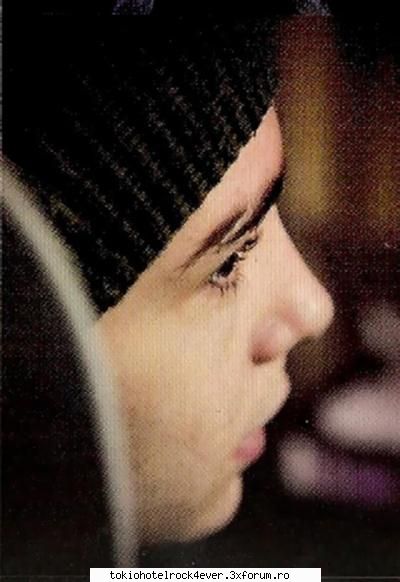 Poza preferata cu Tommy - Tommy are o cicatrice de cand era mic...a dat una - *..::Tom Kaulitz::..*